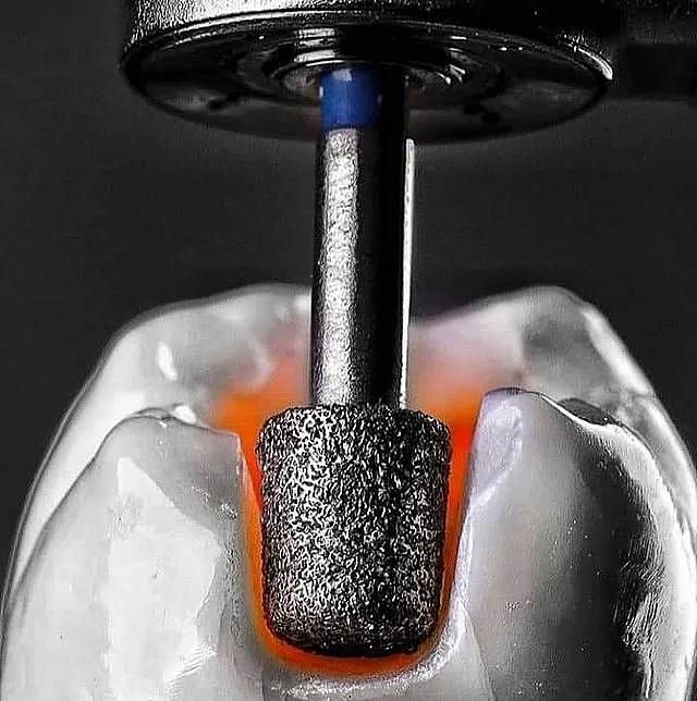 CAM/CAD دندانپزشکی