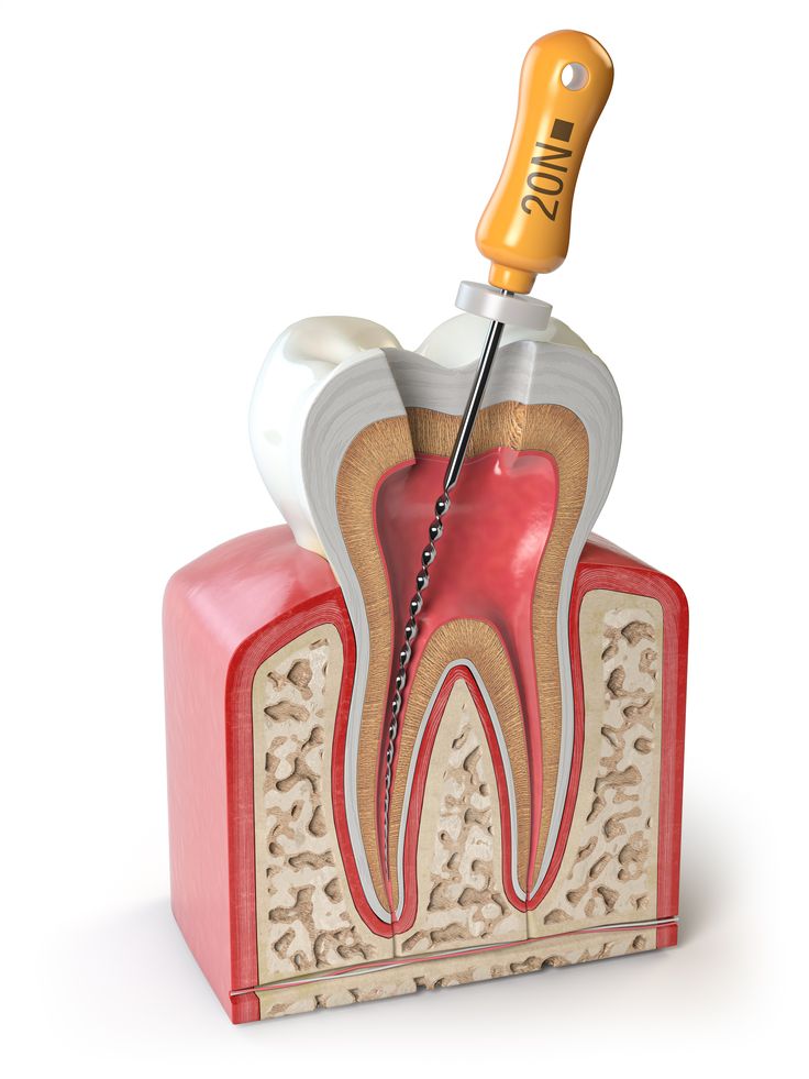 اینسترومنت های جراحی ایمپلنت