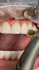 موتور اندو و روتاری