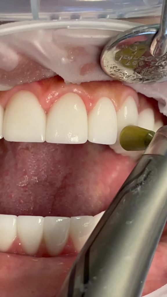 موتور اندو و روتاری